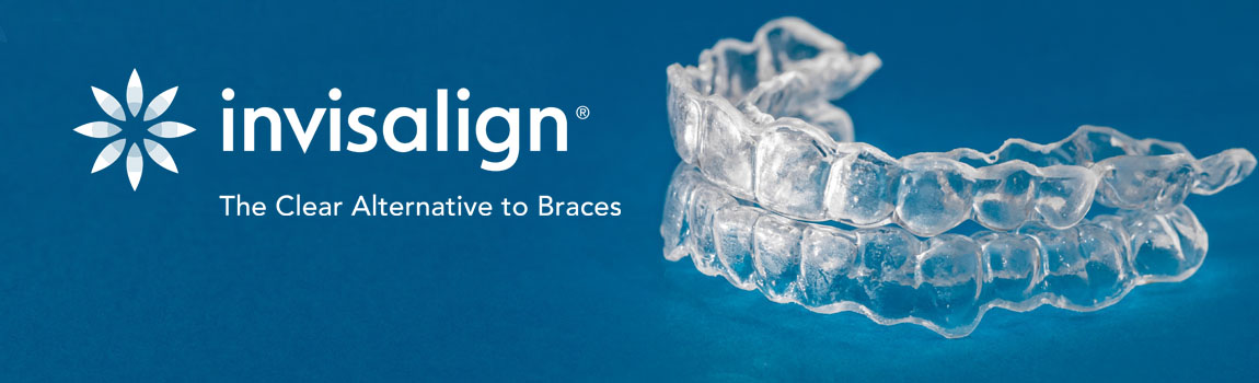 banner showing clear plastic invisalign retainer